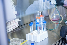 Multiple test tubes in a holder surrounded by lab equipment
