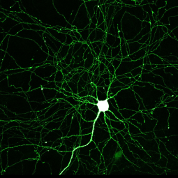 microscopic image of a neuron